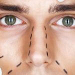 6 MOST POPULAR COSMETIC SURGERIES FOR MEN