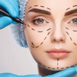 DOS AND DON&#8217;TS A WEEK BEFORE FACELIFT